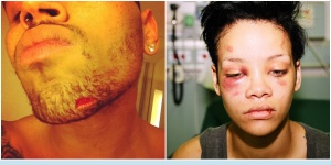Rihanna After Abuse by Chris